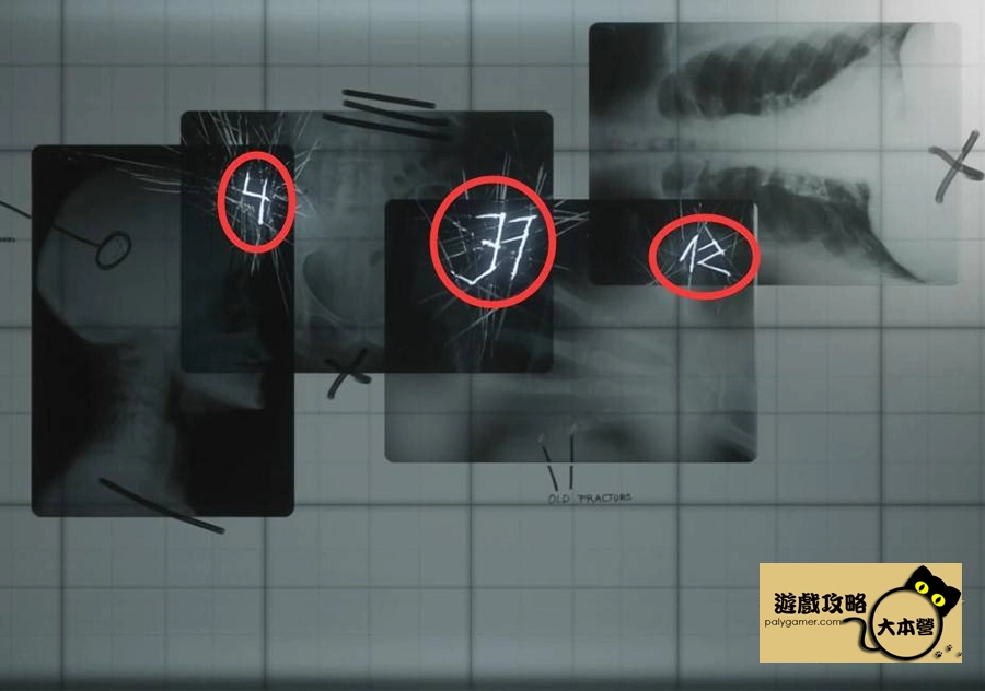《沉默之丘2/寂靜嶺2重製版》全收集(備忘錄、奇怪的照片、舊日迴響的位置)與解謎攻略Silent Hill 2-309